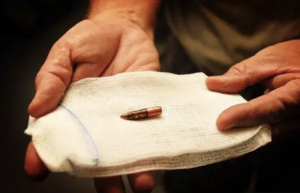 A bullet resting atop a folded sheet of gauze, held by two hands.